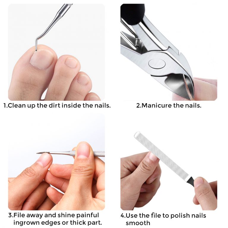 Toenail Clippers for Thick Toenails,4Pcs Precision Stainless Steel Ingrown Toenail Tool Kit